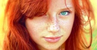 ¿Por qué las personas pelirrojas tienen pecas?