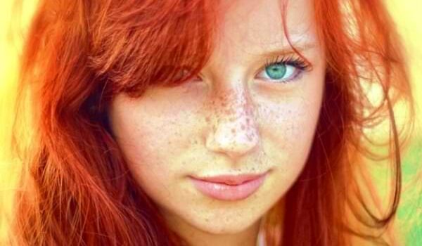 ¿Por qué las personas pelirrojas tienen pecas?